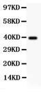 Angio-associated migratory cell protein antibody, PA5-78935, Invitrogen Antibodies, Western Blot image 