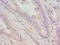 Dentin Matrix Acidic Phosphoprotein 1 antibody, LS-C375597, Lifespan Biosciences, Immunohistochemistry frozen image 