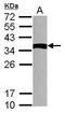 NME/NM23 Family Member 9 antibody, GTX117495, GeneTex, Western Blot image 