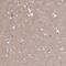 GCSFR antibody, PA5-61646, Invitrogen Antibodies, Immunohistochemistry frozen image 