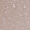 GCSFR antibody, PA5-61646, Invitrogen Antibodies, Immunohistochemistry frozen image 