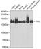 Tripeptidyl Peptidase 2 antibody, GTX16466, GeneTex, Western Blot image 