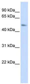 Transmembrane Protein 266 antibody, TA338819, Origene, Western Blot image 