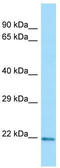 C-Type Lectin Domain Family 3 Member A antibody, TA333933, Origene, Western Blot image 