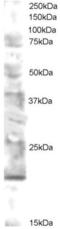 Ubiquitin Conjugating Enzyme E2 V2 antibody, EB05416, Everest Biotech, Western Blot image 