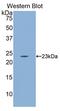 CD8b Molecule antibody, LS-C705760, Lifespan Biosciences, Western Blot image 