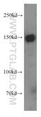 Tau-tubulin kinase 2 antibody, 15072-1-AP, Proteintech Group, Western Blot image 