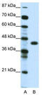Zinc Finger Protein 396 antibody, TA337896, Origene, Western Blot image 