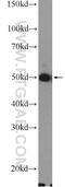 Solute Carrier Family 4 Member 1 (Diego Blood Group) antibody, 18566-1-AP, Proteintech Group, Western Blot image 