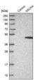 NOP2/Sun RNA Methyltransferase 4 antibody, PA5-55876, Invitrogen Antibodies, Western Blot image 