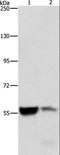 Aldehyde Dehydrogenase 8 Family Member A1 antibody, LS-C401216, Lifespan Biosciences, Western Blot image 