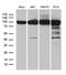 Karyopherin Subunit Beta 1 antibody, LS-C796064, Lifespan Biosciences, Western Blot image 