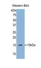 Regenerating Family Member 3 Alpha antibody, LS-C300251, Lifespan Biosciences, Western Blot image 