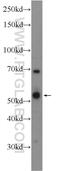 Tryptophan Hydroxylase 2 antibody, 22590-1-AP, Proteintech Group, Western Blot image 