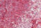 Integrin Subunit Alpha L antibody, MBS248637, MyBioSource, Immunohistochemistry frozen image 