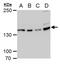 Ubiquitin Specific Peptidase 7 antibody, GTX631109, GeneTex, Western Blot image 