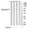 Beta-1,4-N-Acetyl-Galactosaminyltransferase 1 antibody, A07778, Boster Biological Technology, Western Blot image 