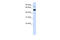 SWI/SNF Related, Matrix Associated, Actin Dependent Regulator Of Chromatin, Subfamily D, Member 1 antibody, 27-154, ProSci, Western Blot image 