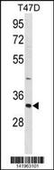 Hepatitis A Virus Cellular Receptor 2 antibody, 60-816, ProSci, Western Blot image 