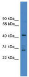 Armadillo Repeat Containing 8 antibody, TA335118, Origene, Western Blot image 