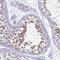 Tripartite Motif Containing 37 antibody, NBP1-92529, Novus Biologicals, Immunohistochemistry paraffin image 