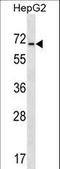 Acid Sensing Ion Channel Subunit Family Member 4 antibody, LS-C155925, Lifespan Biosciences, Western Blot image 