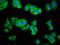 SEL1L Adaptor Subunit Of ERAD E3 Ubiquitin Ligase antibody, LS-C672430, Lifespan Biosciences, Immunofluorescence image 