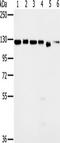 Matrin 3 antibody, TA350157, Origene, Western Blot image 