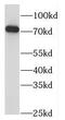 7SK snRNA methylphosphate capping enzyme antibody, FNab05126, FineTest, Western Blot image 