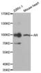 Androgen Receptor antibody, abx001670, Abbexa, Western Blot image 