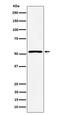 SAMM50 Sorting And Assembly Machinery Component antibody, M06847, Boster Biological Technology, Western Blot image 