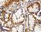 Caspase 10 antibody, PA1513, Boster Biological Technology, Immunohistochemistry paraffin image 
