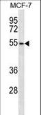 Armadillo Repeat Containing X-Linked 1 antibody, LS-C156502, Lifespan Biosciences, Western Blot image 