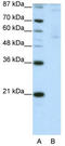 Zinc Finger Protein 92 antibody, TA345559, Origene, Western Blot image 