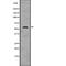 Aldehyde Dehydrogenase 2 Family Member antibody, abx146579, Abbexa, Western Blot image 