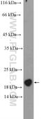 MCTS1 Re-Initiation And Release Factor antibody, 14984-1-AP, Proteintech Group, Western Blot image 
