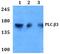 Phospholipase C Beta 3 antibody, A04226-1, Boster Biological Technology, Western Blot image 
