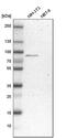 Hydroxyacyl-CoA Dehydrogenase Trifunctional Multienzyme Complex Subunit Alpha antibody, PA5-53317, Invitrogen Antibodies, Western Blot image 