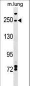 Inverted Formin, FH2 And WH2 Domain Containing antibody, LS-C159924, Lifespan Biosciences, Western Blot image 