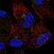Transmembrane Protein 165 antibody, HPA062424, Atlas Antibodies, Immunofluorescence image 