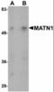 Matrilin 1 antibody, orb94280, Biorbyt, Western Blot image 