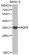 Aquaporin 4 antibody, abx002120, Abbexa, Western Blot image 