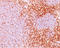 T-cell differentiation antigen CD6 antibody, AM50241PU-T, Origene, Immunohistochemistry paraffin image 