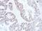 SATB Homeobox 1 antibody, PA5-30163, Invitrogen Antibodies, Immunohistochemistry frozen image 