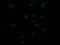 Insulin Receptor antibody, CSB-RA155156A0HU, Cusabio, Immunofluorescence image 