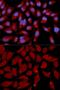 DNA Methyltransferase 3 Alpha antibody, GTX55596, GeneTex, Immunofluorescence image 