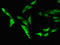 Calpain 14 antibody, LS-C677377, Lifespan Biosciences, Immunofluorescence image 