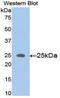Matrix Metallopeptidase 11 antibody, LS-C297896, Lifespan Biosciences, Western Blot image 
