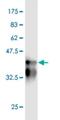NIMA Related Kinase 5 antibody, H00341676-M01, Novus Biologicals, Western Blot image 