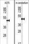 CDK2 Associated Cullin Domain 1 antibody, LS-C156915, Lifespan Biosciences, Western Blot image 